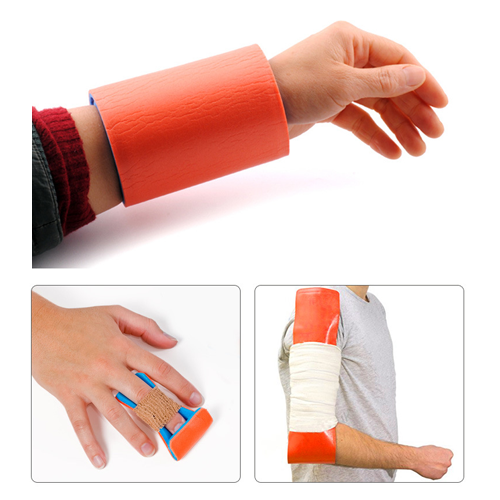 Polymer fracture fixation splint